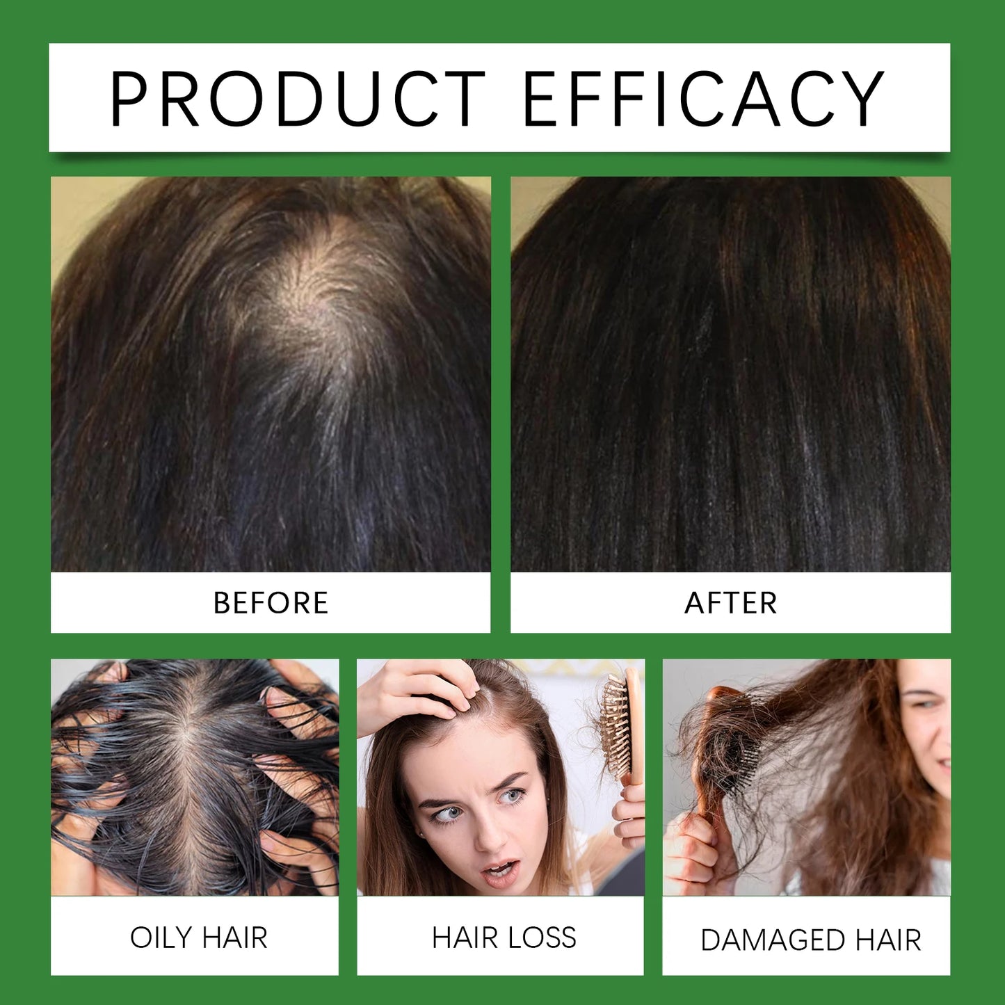 Rosemary Rice Water Hair Growth Spray