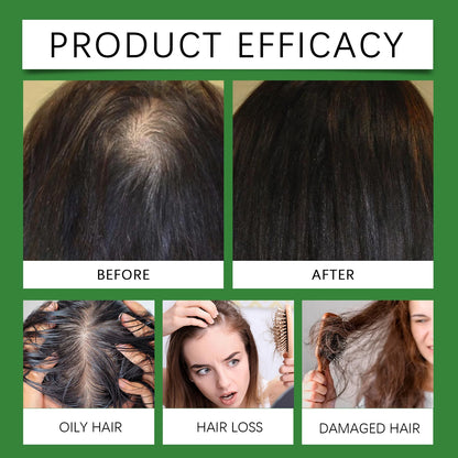 Rosemary Rice Water Hair Growth Spray